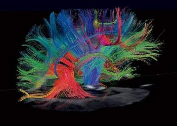 Neurociencia, arte: increíbles imágenes del cerebro humano 